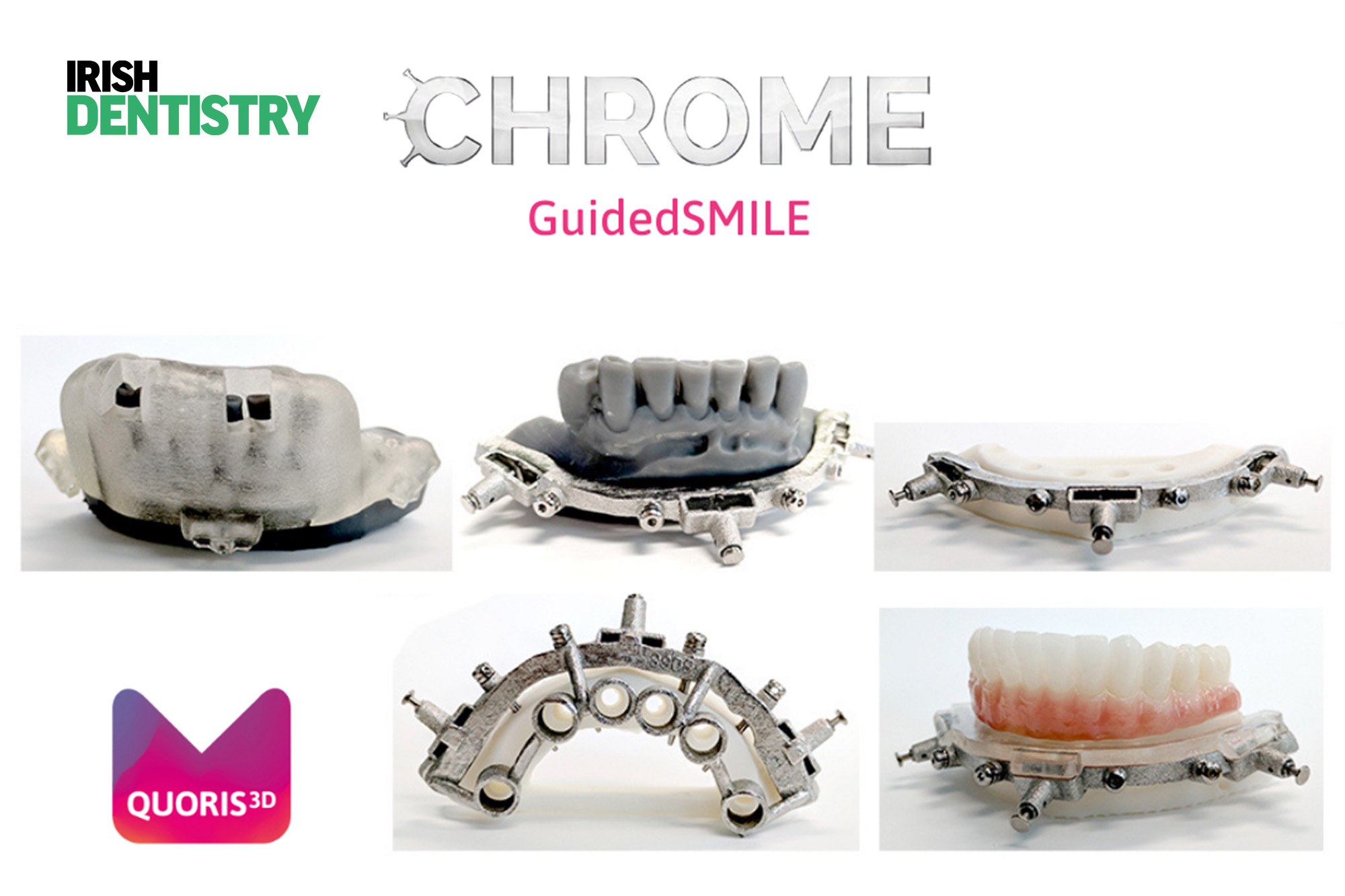 Julian English visited the LS Browne Centre in Enniskillen, to find out all about Chrome Guidedsmile surgery.